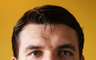 发际线太高怎么办男（5个方法拯救发际线）