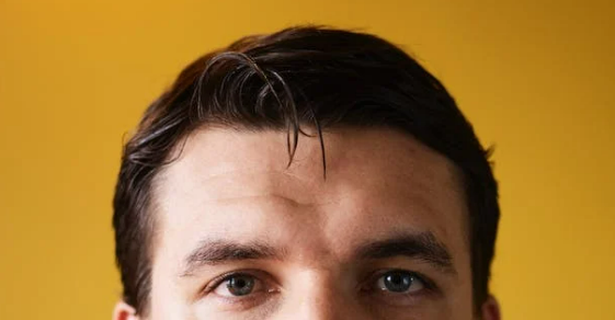 发际线太高怎么办男(5个方法拯救发际线)-第1张图片 发际线太高怎么办男(5个方法拯救发际线)-第1张图片